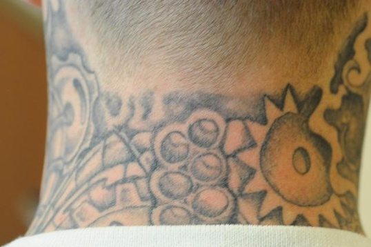 PicoSure Tattoo Removal Helps Cincinnati Ex-Felons Get a Second Chance