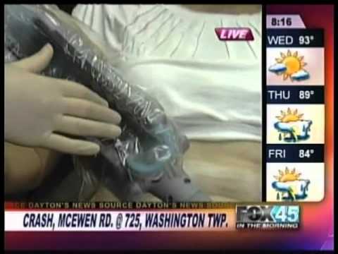 Coolsculpting now available in Dayton/Cincinnati Coolsculpting now available in Dayton/Cincinnati