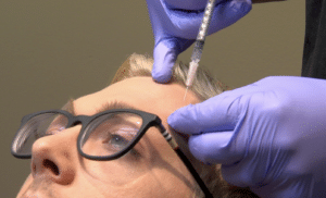 Botox-cincinnati-dr-jon-mendelsohn-liz-bonis-men-botox-injection-popular-areas