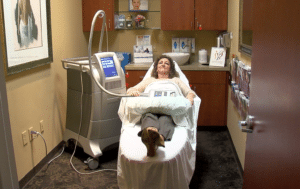 coolsculpting patient treatment