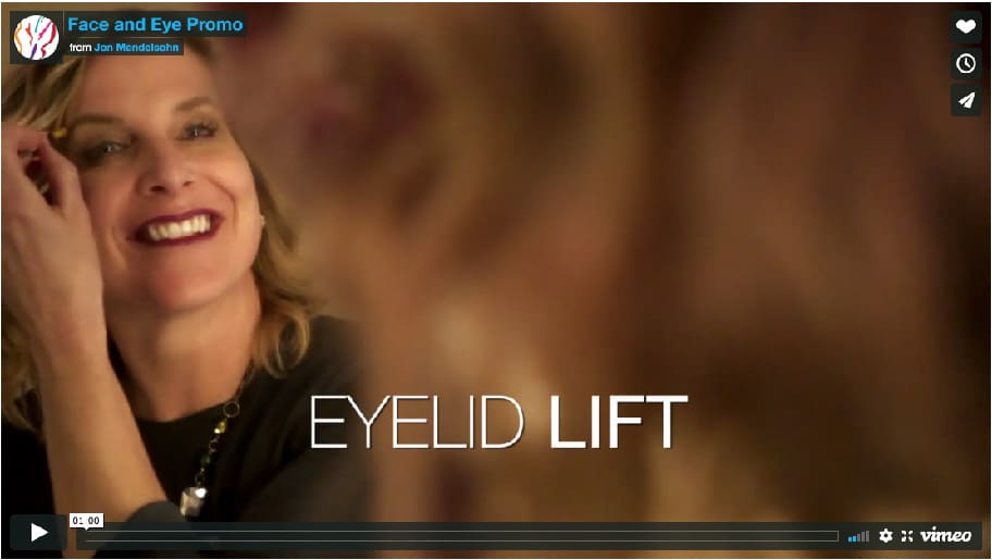eyelid lift testimonial