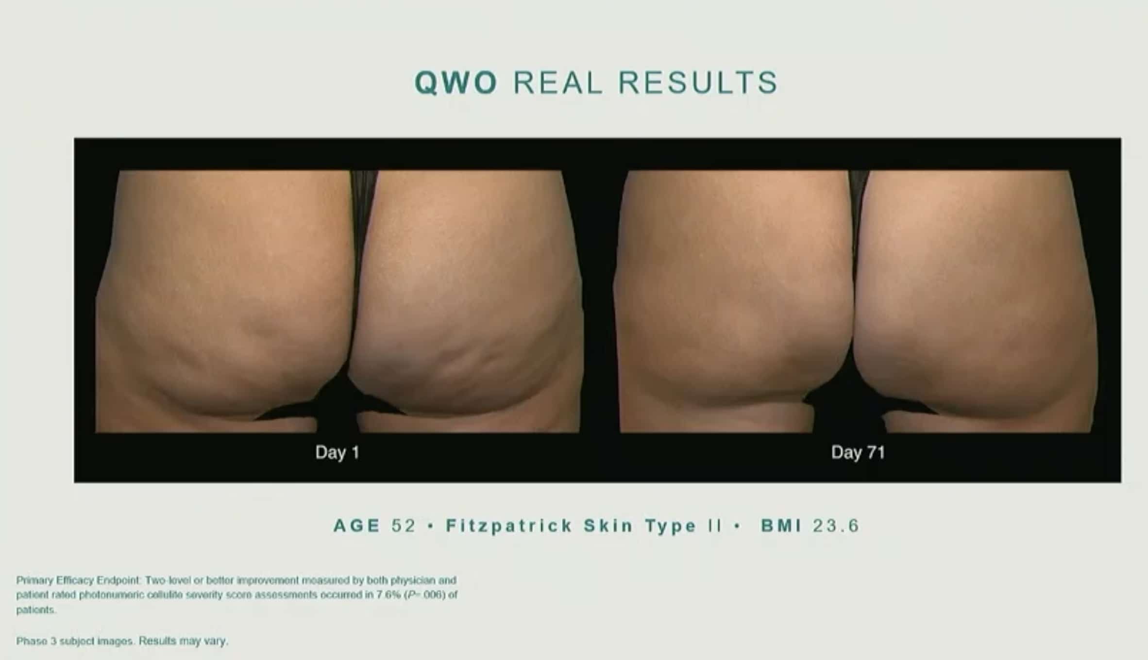 qwo real results before and after